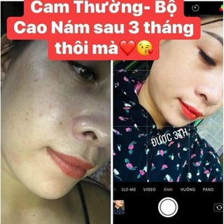 combo face nám ball luta