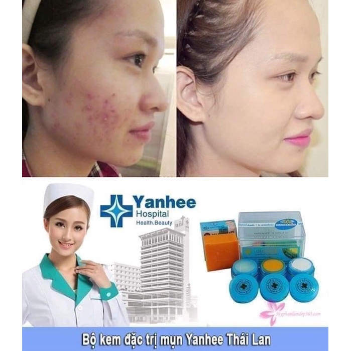 BỘ KEM MỤN,KEM THAM MỤN CHUYÊN SAU THÁI LAN