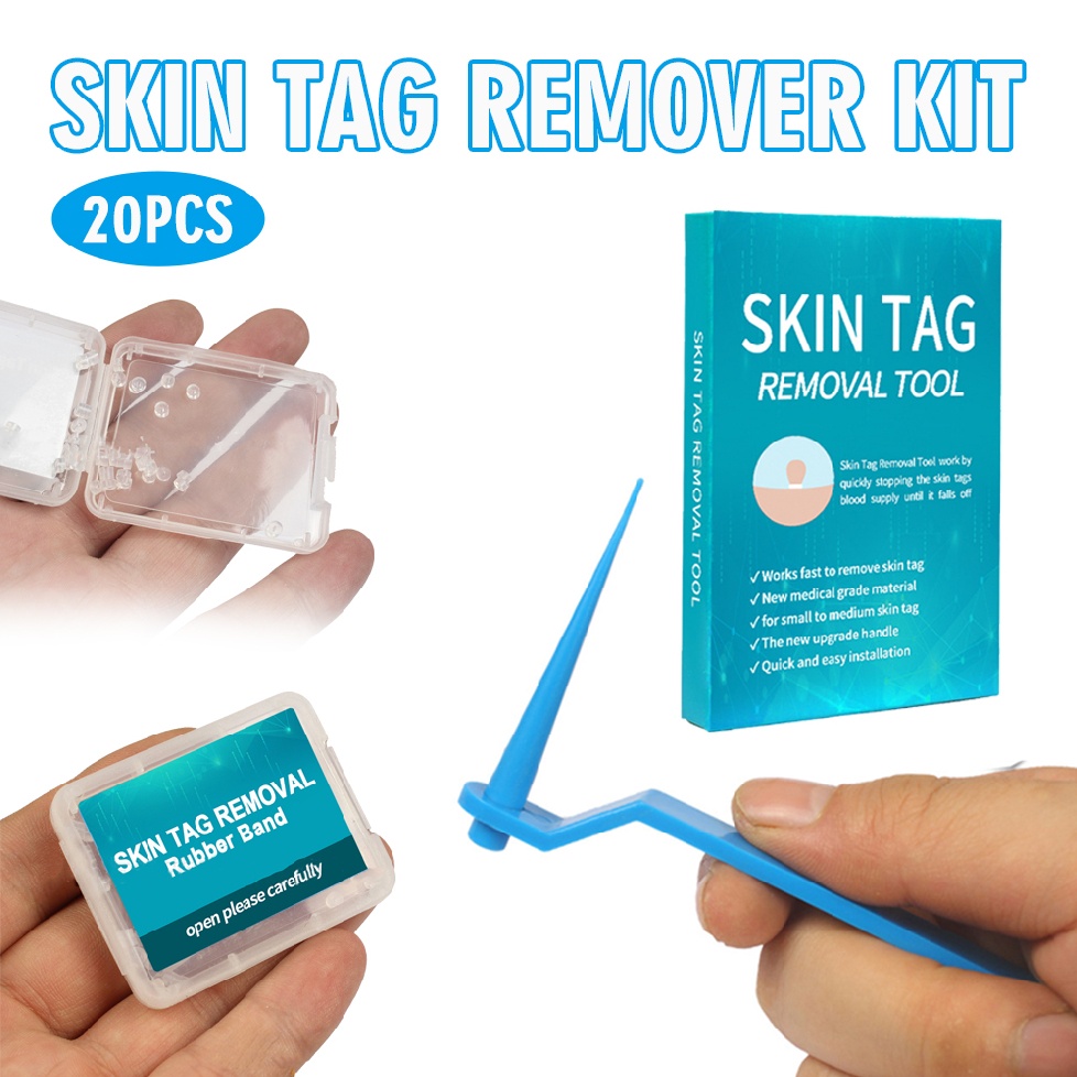 [Hàng mới về] Set dụng cụ loại bỏ mụn thịt có 20 đai cao su chuyên dụng