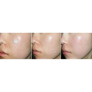 TẨY DA CHẾT ROSETTE PEELING GEL