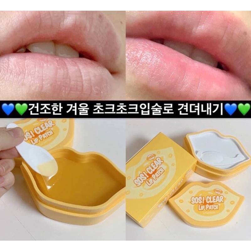 [Có bill]MẶT NẠ MÔI BERRISOM SOS ESSENCE LIP PATCH