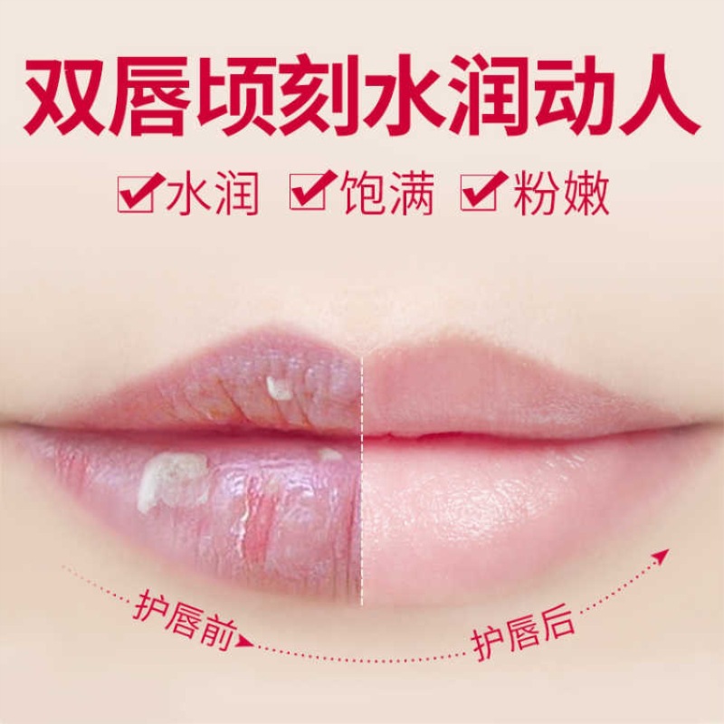 [Hàng mới về] Mặt nạ môi để qua đêm dưỡng ẩm cải thiện làm mờ đường viền thâm môi hiệu quả