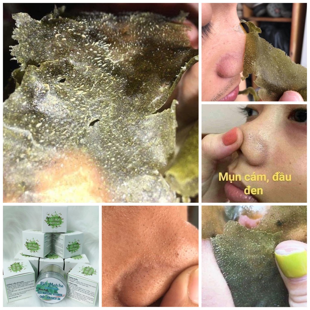 (COMBO 3) LỘT MỤN TRÀ XANH LỘT SẠCH MỤN CỰC XỊN | BigBuy360 - bigbuy360.vn