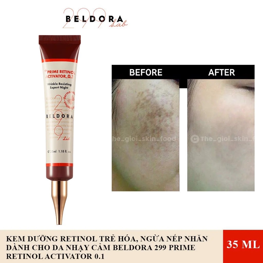 Kem Dưỡng Retinol Trẻ Hóa Da, Ngăn Ngừa Nếp Nhăn Dành Cho Da Nhạy Cảm Beldora 299 Prime Retinol Activator 0.1 35ml