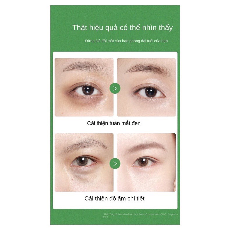 Kem mắt chiết xuất từ quả bơ hàng nội địa Trung