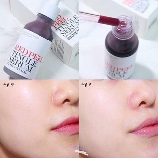 Serum RED PEEL TINGLE - White Serum tinh chất thay da sinh học peel da nhập khẩu chính hãng 35ml