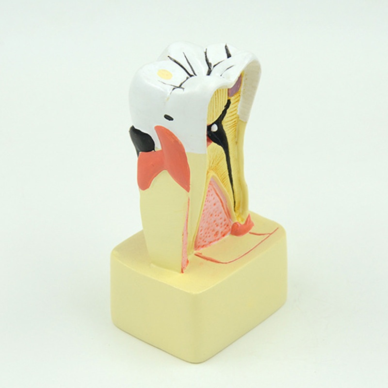 blg Dental Model Periodontal Disease Analysis for Dentist Teaching Dentistry Clinic