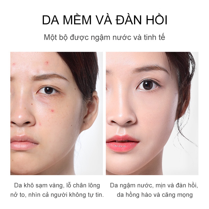 BEATIZZA Bộ 2 mảnh Sự kết hợp giữa bộ kem dưỡng da làm dịu-làm trẻ hóa làn da,kiểm soát dầu,Dưỡng ẩm(BDS-RY-1+BDS-RY-2)
