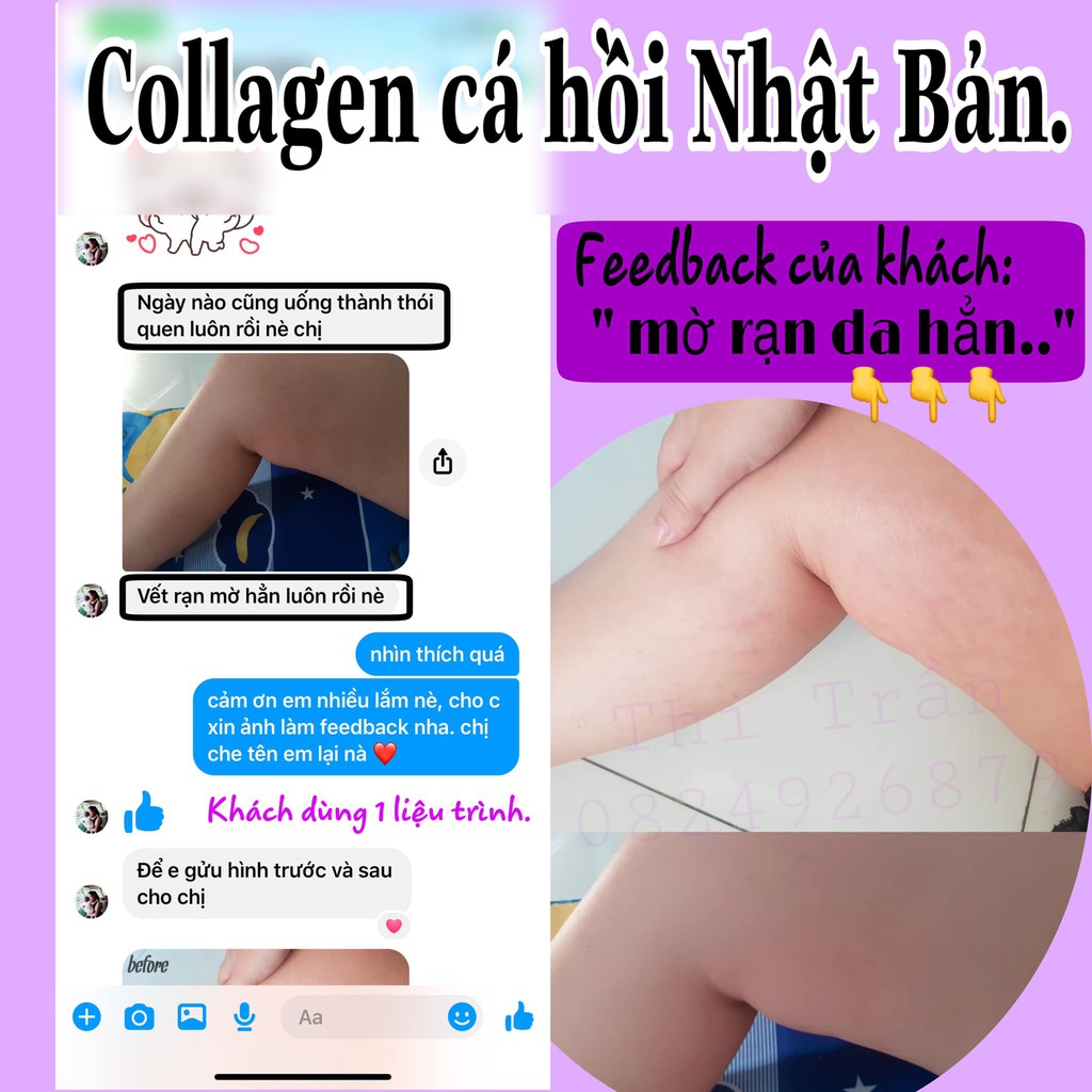 Combo liệu trình 3 gói Collagen cá hồi Pizkie | BigBuy360 - bigbuy360.vn