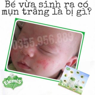 Combo 4 hộp Elemis tắm gội thảo dược cho bé tặng 1 rửa tay khô