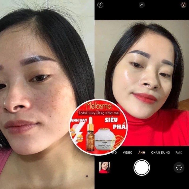 Cao nám - Se khít lỗ chân lông hoa hồng Lodas cream Đan Thy