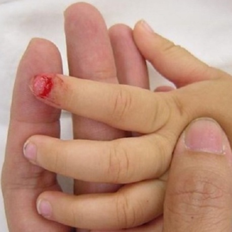 Nút Bịt Ổ Điện Chống Giật  Cái Giữ An Toàn Cho Bé