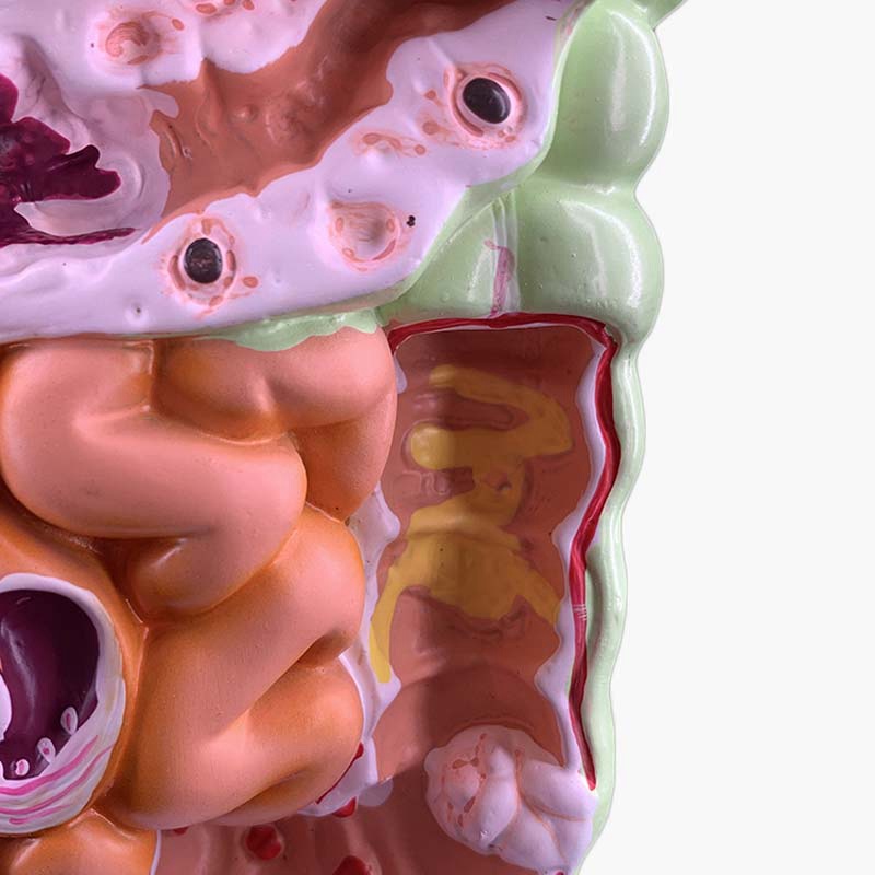 Mô Hình Cấu Trúc Nội Thất Cơ Thể Người Kích Thước Lớn Ruột Lớn Cecum Duodenum