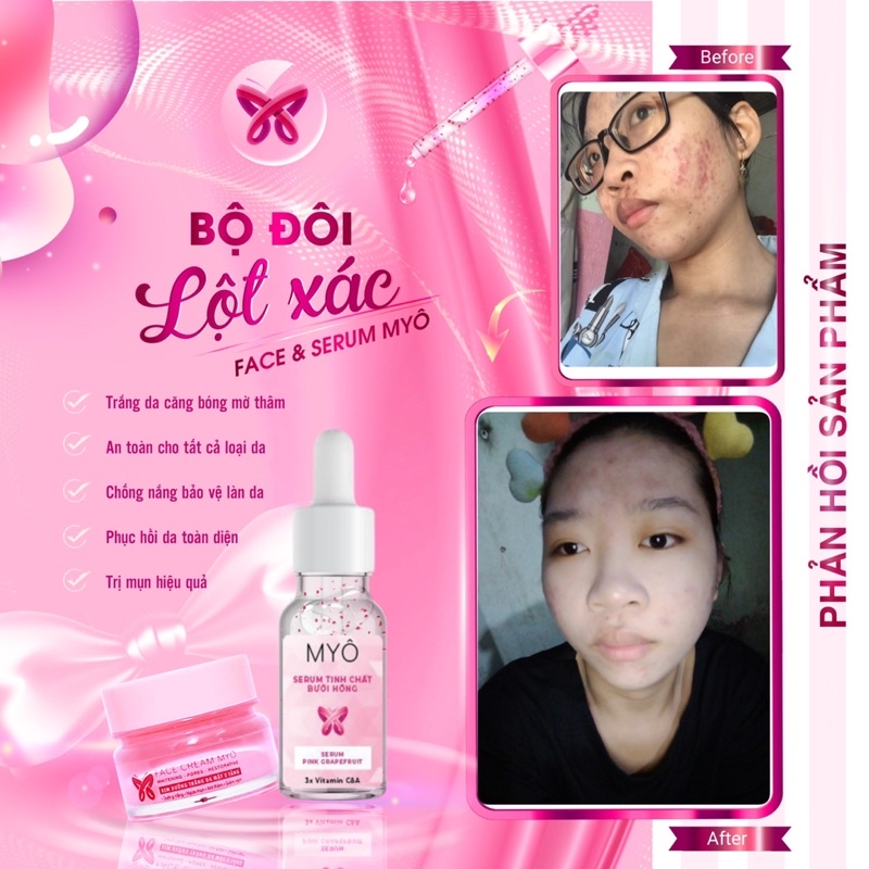 [CHÍNH HÃNG] COMBO SERUM + FACE 2TẦNG Dưỡng TrẮng Da Căng Bóng Mỗi Ngày