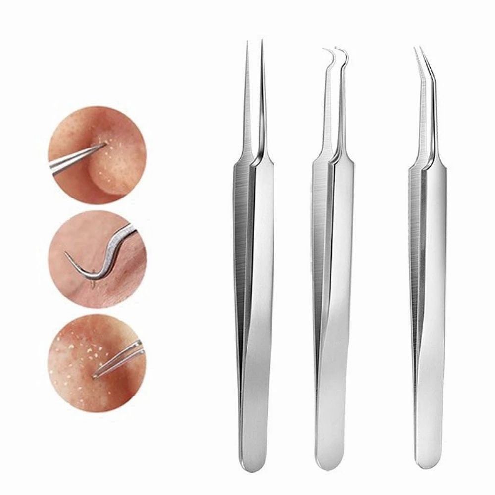 Nhíp gắp mụn, nặn mụn đầu đen loại 1 thép xịn