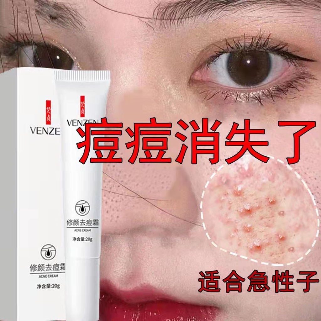 Kem Hỗ Trợ Giảm Mụn Trứng Cá Làm Mờ Vết Thâm Mụn Phục Hồi Miệng Trẻ Hóa Làn Da Cho Học Sinh Manshanzc.My11.27 | BigBuy360 - bigbuy360.vn