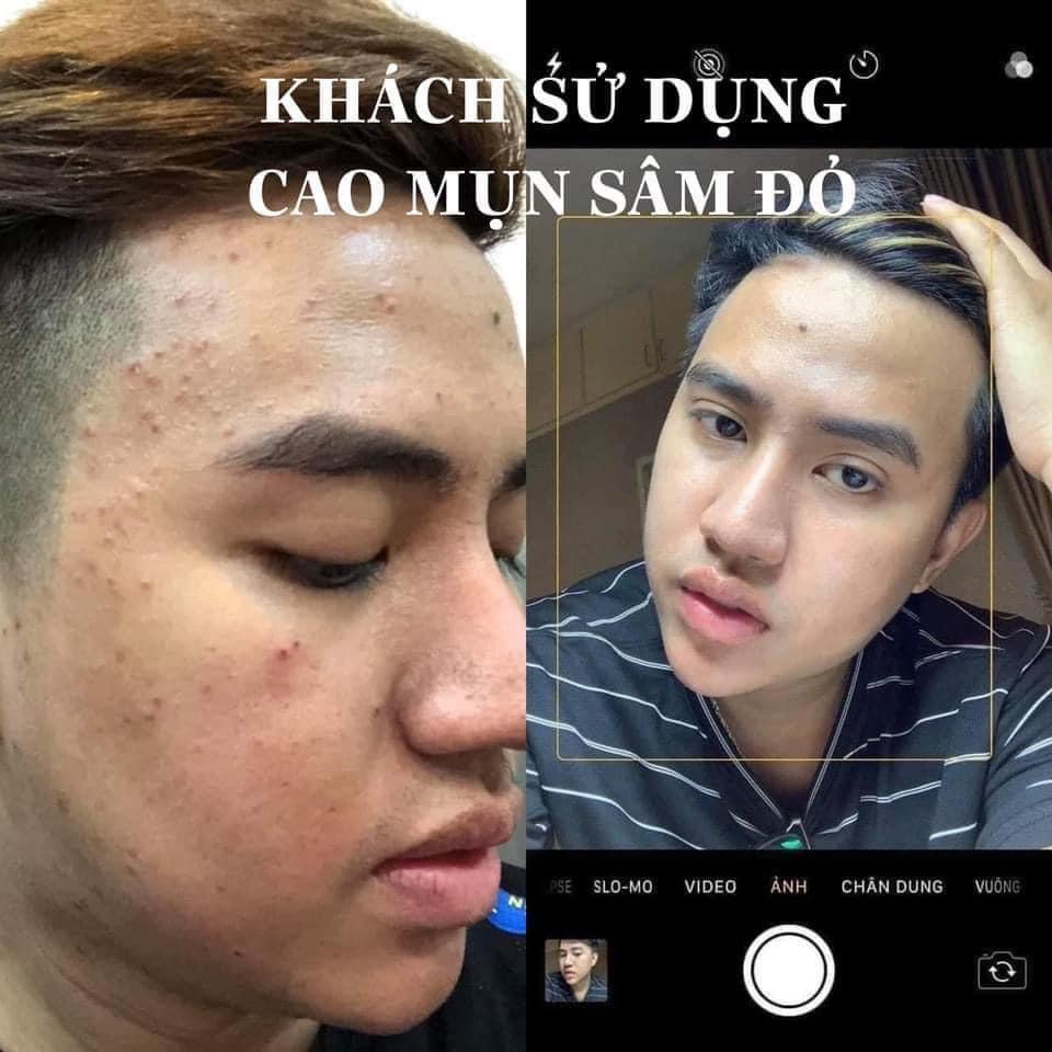 Cao mụn sâm đỏ 36 vị MEEA Organic chính hãng, triệt sạch mọi loại mụn, dưỡng trắng mịn da, mờ thâm nám, dưỡng da đẹp | BigBuy360 - bigbuy360.vn