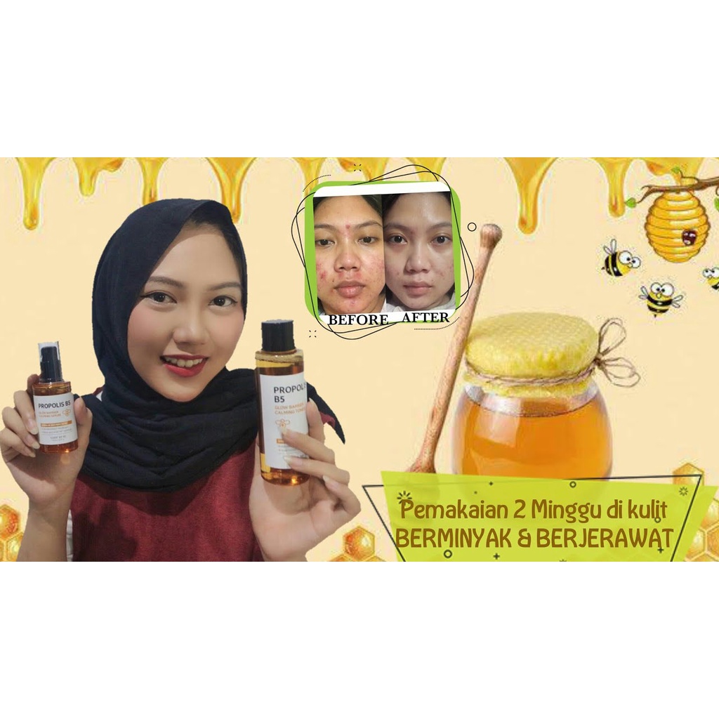 Nước Hoa Hồng Làm Dịu Da Chiết Xuất Mật Ong SOMEBYMI Propolis B5 Glow Barrier Calming Toner 150ml