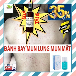 Viêm Nang Lông, Viêm Lỗ Chân Lông, Mụn Lưng Dứt Điểm Hoàn Toàn Bởi Serum Trái Cây Tavida. Làng Da Đẹp Trong Tầm Tay.