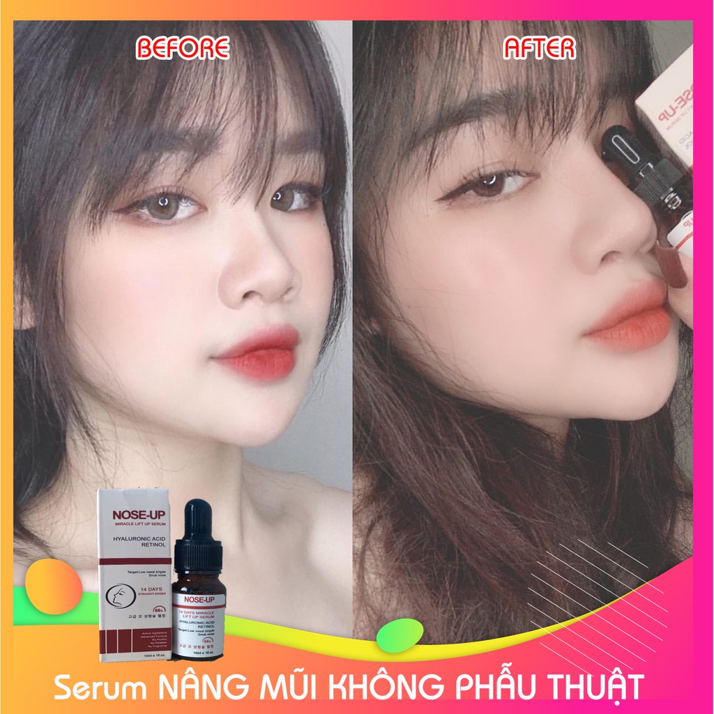 Serum, tinh chất nâng mũi  Hàn Quốc NOSE UP, hiệu quả, an toàn hơn sụn nâng mũi 3D Hàn quốc kẹp nâng mũi và phẫu thuật