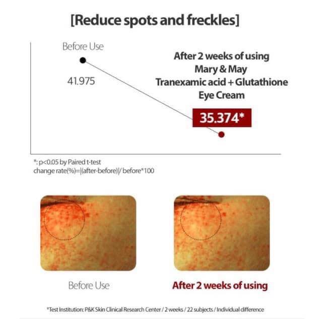 KEM MẮT dưỡng trắng giảm thâm quầng mắt kiêm kem nám Mary&May