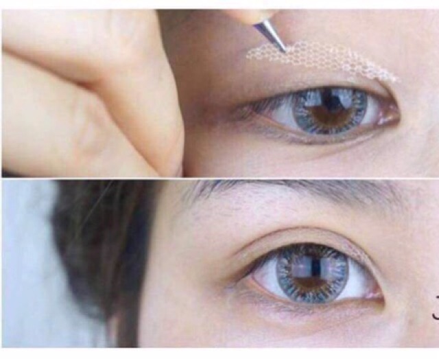 Miếng Dán Mí Lưới Keli Allergy Double Eyelid Stickers