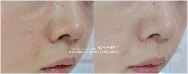 Sữa Rửa Mặt Tro Núi Lửa Innisfree Jeju Volcanic Pore Cleansing Foam EX