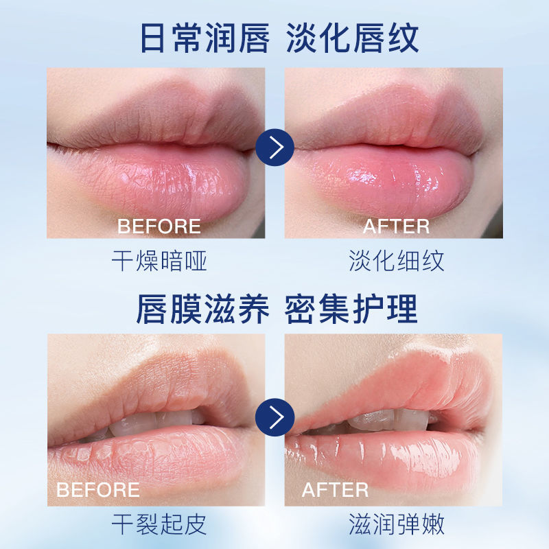 (Hàng Mới Về) Mặt Nạ Môi Vaseline Dưỡng Ẩm Chống Nứt Nẻ Môi