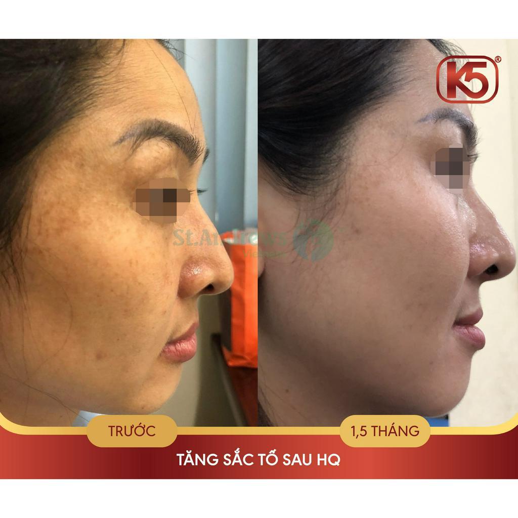 Kem sáng da, mờ thâm sạm K5 Lipogel 40ml - đẩy lùi nám, giúp da sáng đều màu