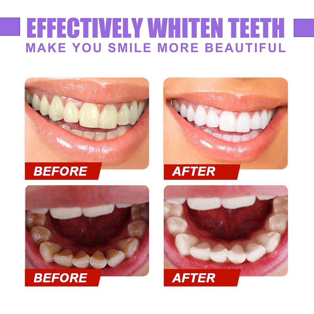 Kem Đánh Răng SUMU V34 Chỉnh Sửa Răng Miệng Thoáng Khí Làm Sạch Nhạy Cảm