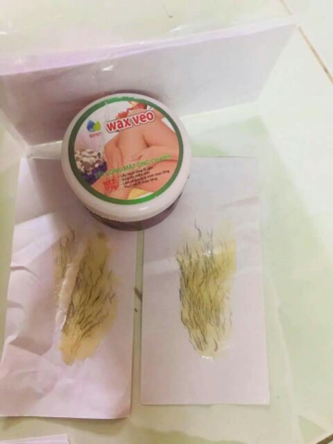 Tẩy lông Wax veo Ngân Bình