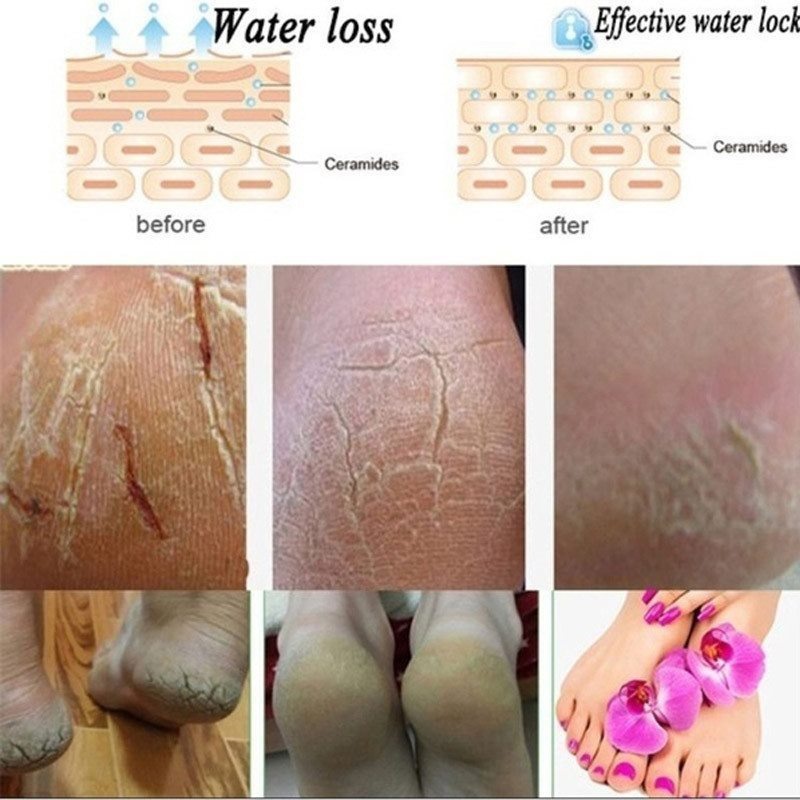 [Hàng mới về] Vớ silicon dưỡng ẩm chăm sóc gót chân