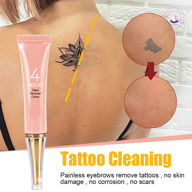 Kem Xóa Hình Xăm Vĩnh Viễn Không Cần Đau Cho Loại Bỏ Hình Xăm