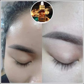 siêu phẩm kích mi, mọc tóc Zenpali