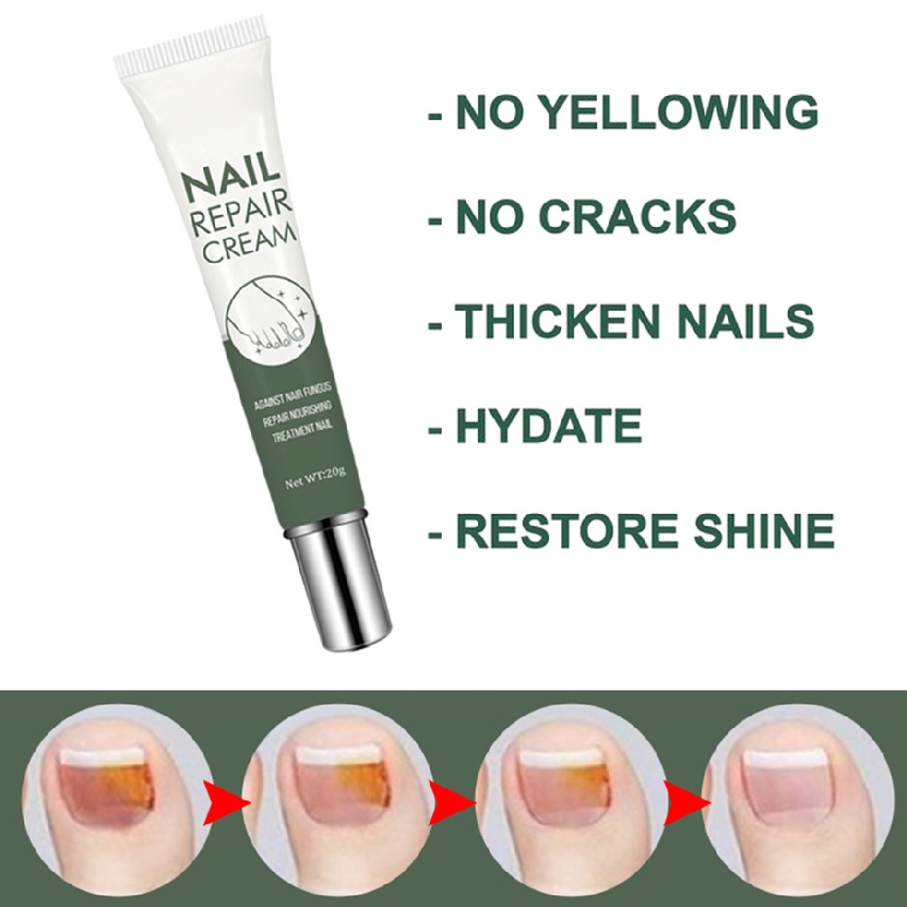 [Hàng mới về] Kem dưỡng phục hồi móng bị hư hỏng mất màu dành cho chăm sóc móng chân 20g