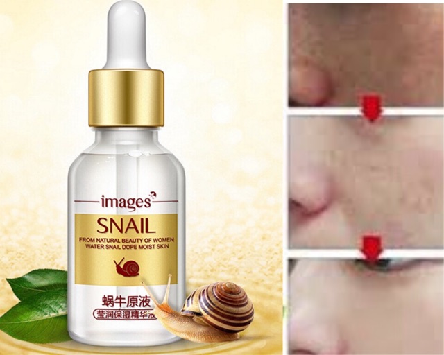 Serum dưỡng trắng mờ thâm rỗ trẻ hoá làn da giúp căng bóng tinh chất thiên nhiên ốc sên hàng nội địa Images