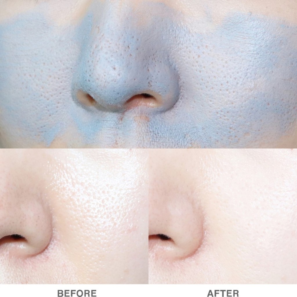 THANH LĂN MỤN ĐẦU ĐEN NEOGEN DERMALOGY 28g | BigBuy360 - bigbuy360.vn