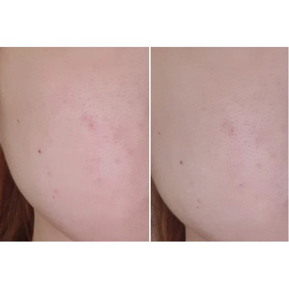 Kem chống nắng Dr.G Green Mild Up Sun SPF 50/PA+++ 50ml