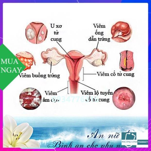 Sản phẩm An Nữ Đan giúp giảm kích thước u nang buồng trứng, phòng ngừa ung thư, hộp 60 viên
