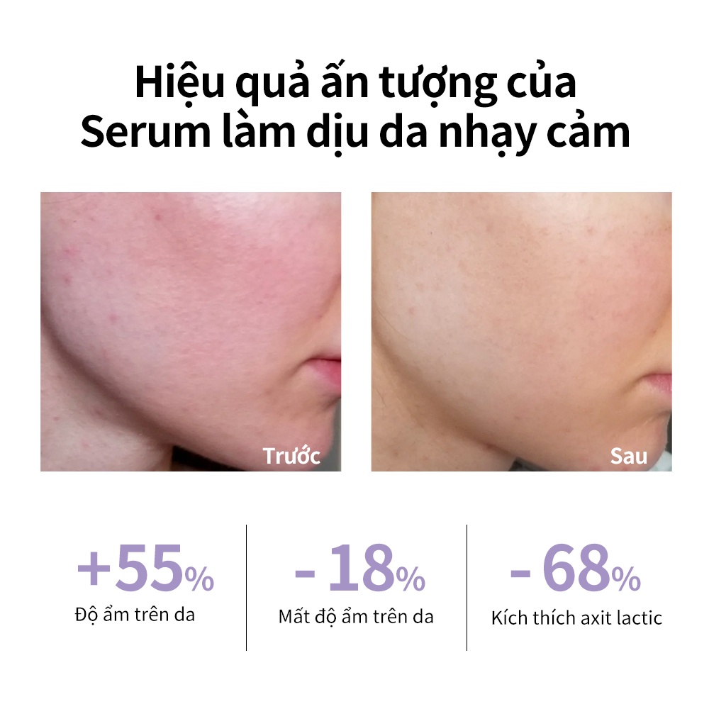 Serum Niacinamide Lanbena Dưỡng Trắng Da Chống Lão Hóa 30ml/15ml