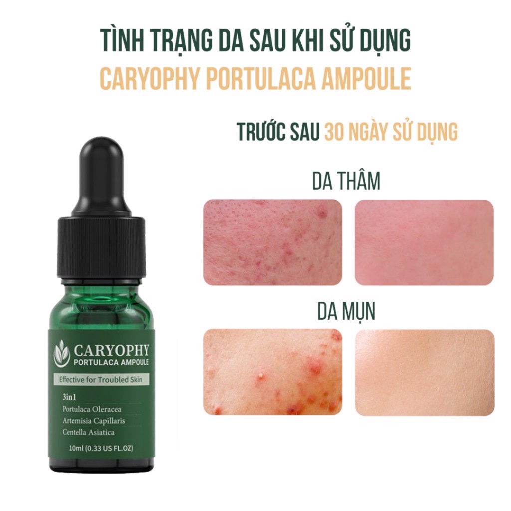 Tinh Chất Giảm Mụn Caryophy 10ml