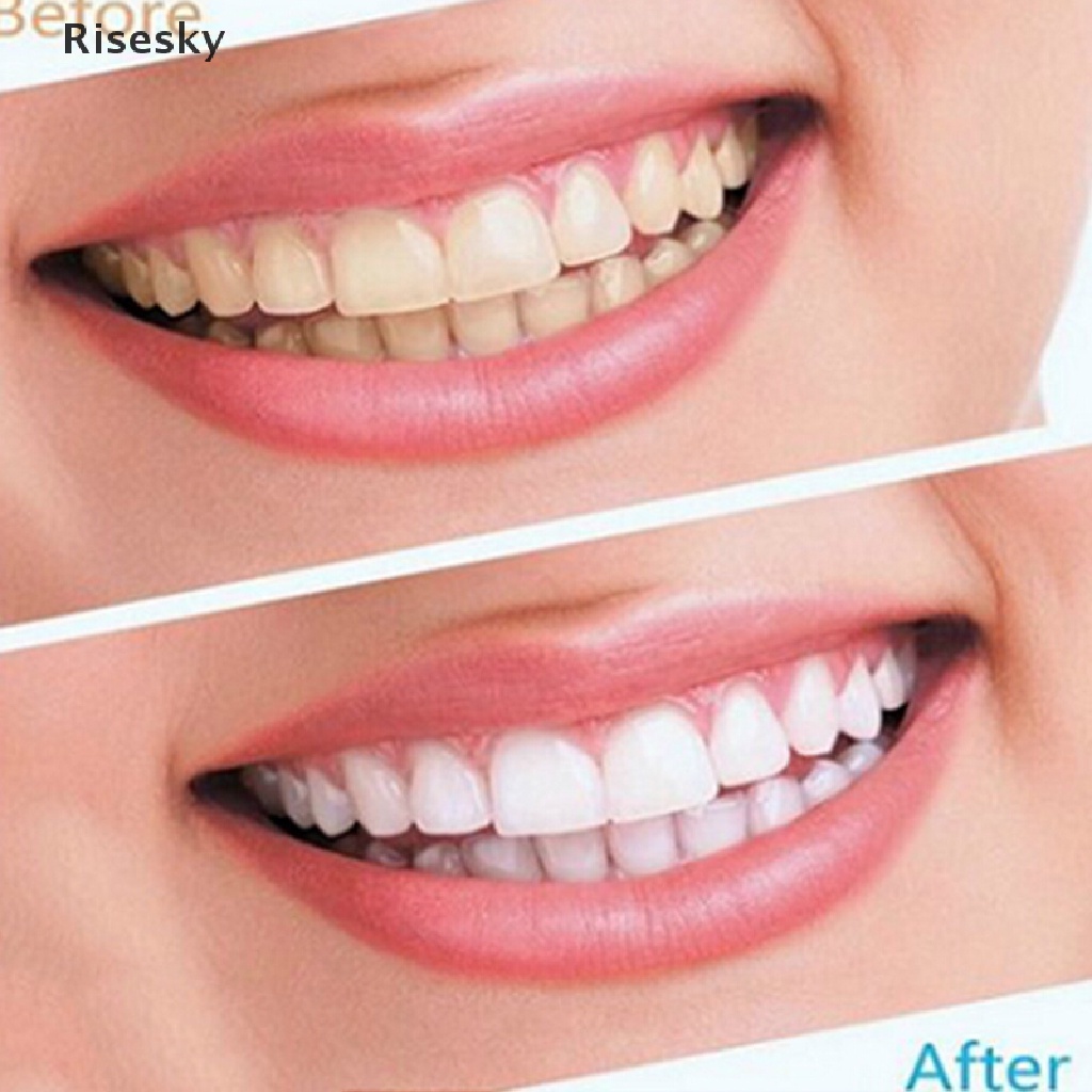 Bộ 2 Dụng Cụ Vệ Sinh Răng Miệng Chất Lượng Cao