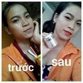Kem Face Trắng Da Dạng Lotion Mwhite