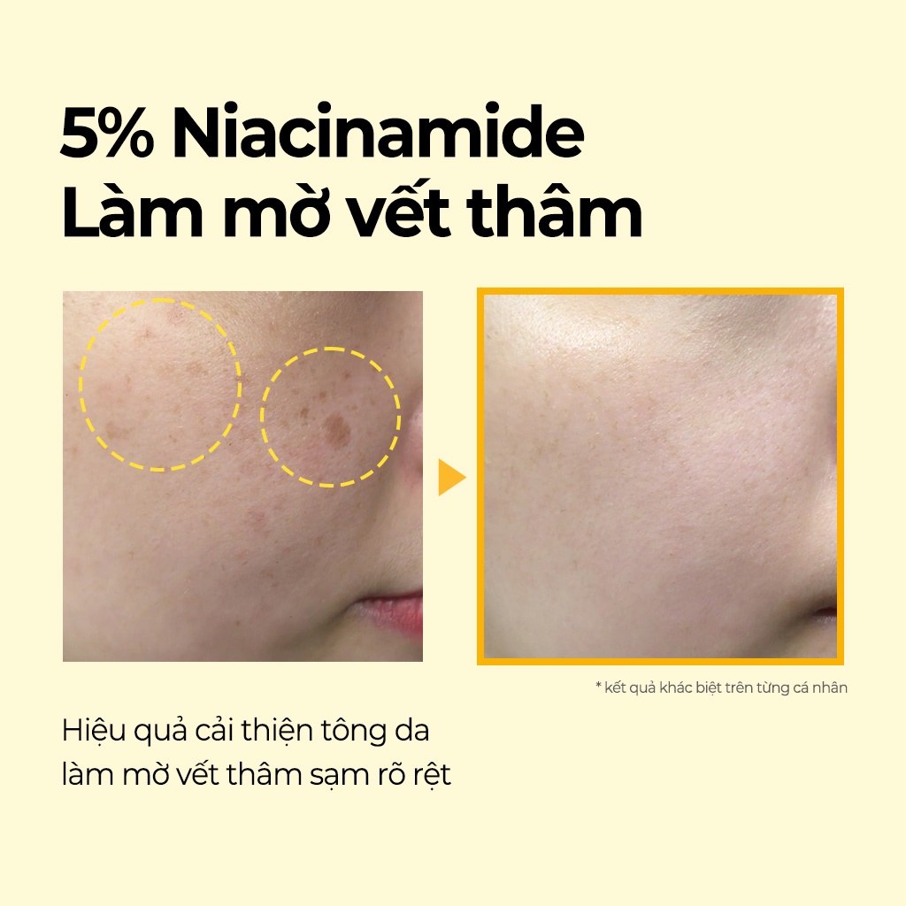 Thanh lăn NIACINAMIDE 5% sáng da mờ thâm SOME BY MI Yuja Niacin Dark Spot Correction Stick 10g