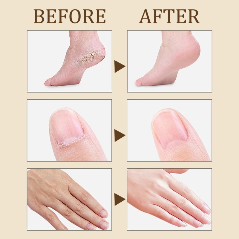 Kem Dưỡng Da Chân YOUYO Tẩy Da Chết Chống Khô Nứt Nẻ Gót Chân