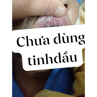 Tinh dầu răng miệng