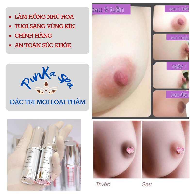 Kem Làm Hồng Nhũ Hoa Và Bikini N1 NeiPink Cream 10ml ( Mẫu Mới ) | BigBuy360 - bigbuy360.vn