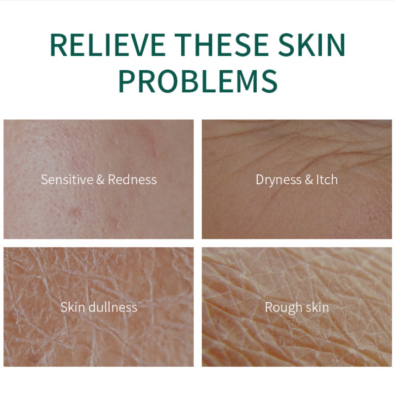 [Hàng mới về] Hộp 20 mặt nạ ngủ dạng thạch dưỡng ẩm kiềm dầu LAIKOU