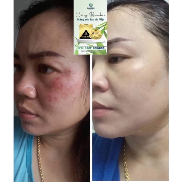 🎋𝗖𝗵𝗶́𝗻𝗵 𝗛𝗮̃𝗻𝗴 𝗕𝗮𝗺𝗯𝗼𝗼-𝗚𝗶𝗮́ 𝗖𝘁𝘆🎋Set Kem Face+Serum Bamboo - dưỡng trắng nhanh,căng bóng