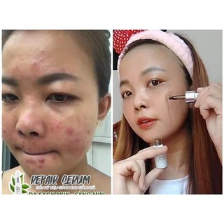 Serum rễ cây mật gấu CENLIA